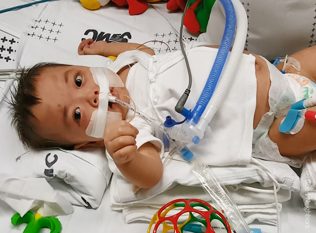 캐뉼라를 꽂고 있는 어린 승영이