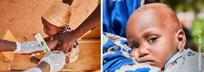 아프리카 아이의 팔둘레 재는 모습 이미지와 아프리카 아이가 기대어 있는 모습