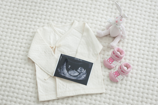 아기 옷과 신발, 초음파 사진